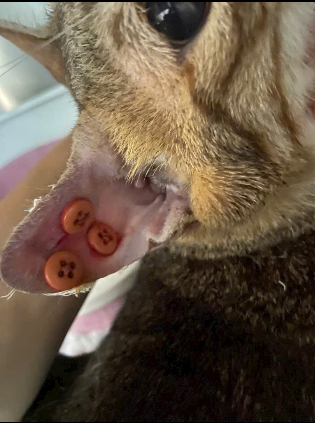 điều trị tụ máu